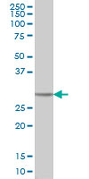 CA1 monoclonal antibody (M05), clone M1