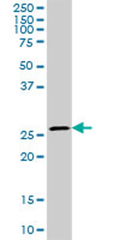 CA1 purified MaxPab rabbit polyclonal antibody (D01P)