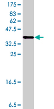 FMNL1 polyclonal antibody (A01)