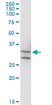 MPPED2 monoclonal antibody (M08), clone 4H5