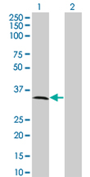 MPPED2 monoclonal antibody (M01A), clone 2G1-1B7