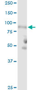 C1R purified MaxPab rabbit polyclonal antibody (D01P)