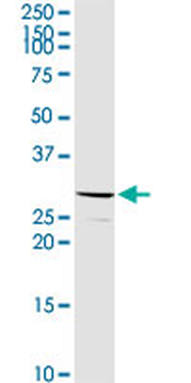 C1QB purified MaxPab rabbit polyclonal antibody (D01P)