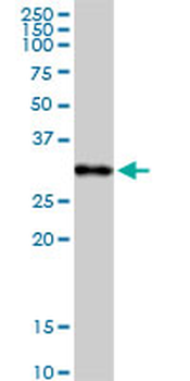 C1QA purified MaxPab rabbit polyclonal antibody (D01P)