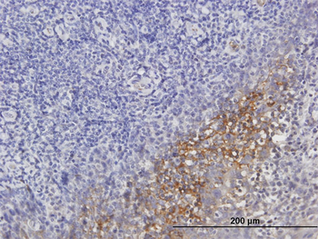 SERPING1 purified MaxPab mouse polyclonal antibody (B01P)