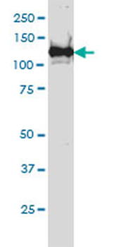 BUB1B monoclonal antibody (M03), clone 3F2