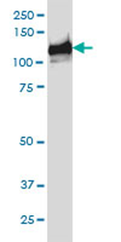 BUB1B monoclonal antibody (M02), clone 2G5
