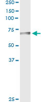 BTD monoclonal antibody (M01), clone 3B10-2B3