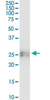 BST2 monoclonal antibody (M15), clone 2E6