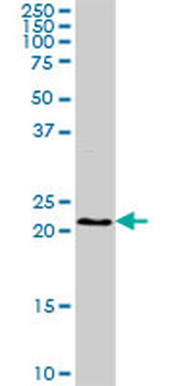 BST2 purified MaxPab rabbit polyclonal antibody (D02P)
