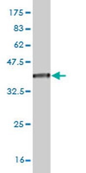 ZFP36L1 monoclonal antibody (M02), clone 1A3