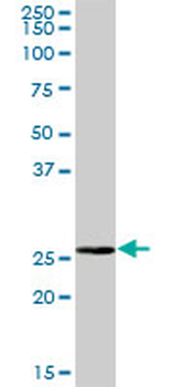 BPHL purified MaxPab mouse polyclonal antibody (B01P)