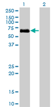 BMPR1A monoclonal antibody (M01), clone 4C4
