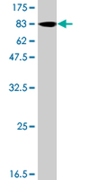 BMPR1A polyclonal antibody (A03)