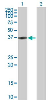 BLVRA purified MaxPab rabbit polyclonal antibody (D01P)