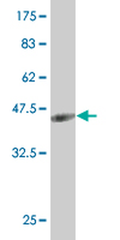 PRDM1 monoclonal antibody (M04), clone 2F8