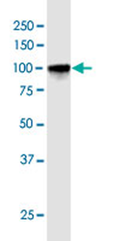 PRDM1 MaxPab rabbit polyclonal antibody (D01)