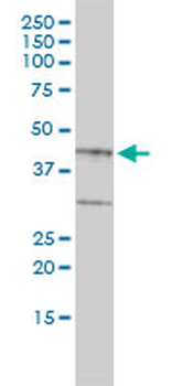 BGN monoclonal antibody (M01), clone 4E1-1G7