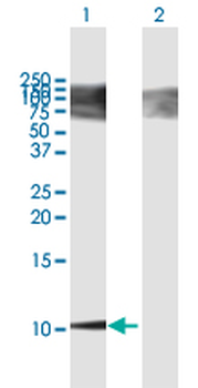 BGLAP purified MaxPab mouse polyclonal antibody (B01P)