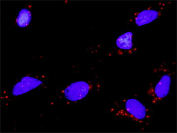BDNF purified MaxPab rabbit polyclonal antibody (D01P)