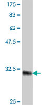 BDKRB2 polyclonal antibody (A01)