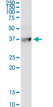 BDKRB1 monoclonal antibody (M04), clone 3A2