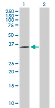 BDKRB1 purified MaxPab rabbit polyclonal antibody (D01P)