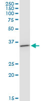 BDH1 monoclonal antibody (M03), clone 4B3