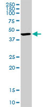 BDH1 purified MaxPab rabbit polyclonal antibody (D01P)