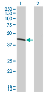 BCS1L monoclonal antibody (M01), clone 5F3