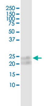 TNFRSF17 MaxPab rabbit polyclonal antibody (D01)
