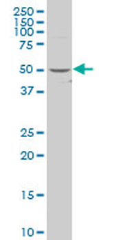 BCKDHA polyclonal antibody (A01)