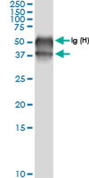 BCAT2 MaxPab rabbit polyclonal antibody (D01)
