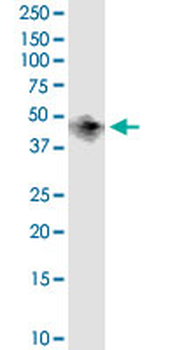 BCAT1 monoclonal antibody (M02), clone 1F8