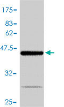 BAX polyclonal antibody (A01)