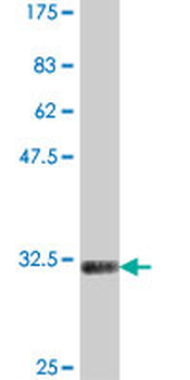 BAPX1 polyclonal antibody (A01)