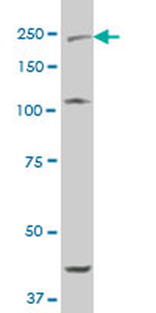 BAI2 polyclonal antibody (A01)