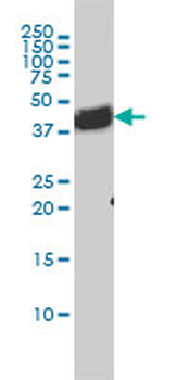 BAG1 monoclonal antibody (M04), clone 4C10