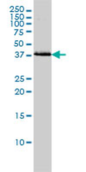 BAG1 monoclonal antibody (M02), clone 2D3