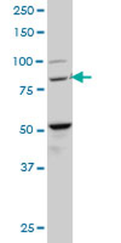 BACH1 monoclonal antibody (M02), clone 1B8
