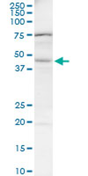BAAT monoclonal antibody (M03), clone 1E4