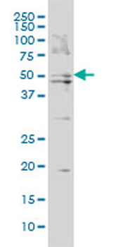 BAAT monoclonal antibody (M02), clone 5B6