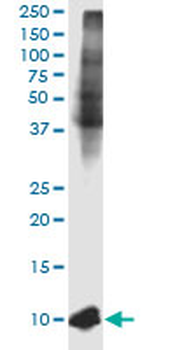 B2M monoclonal antibody (M01J), clone 3F9-2C2