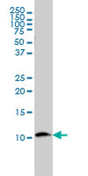 B2M monoclonal antibody (M01), clone 3F9-2C2