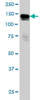 AXL monoclonal antibody (M01), clone 6C8