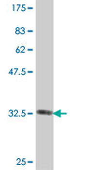 AUH polyclonal antibody (A01)