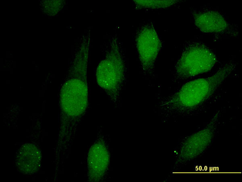 ATRX monoclonal antibody (M03), clone 5B3