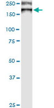 ATP7B monoclonal antibody (M01), clone 3E10