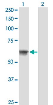 ATP6AP1 monoclonal antibody (M02), clone 3B11