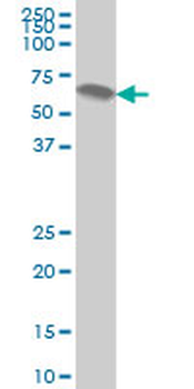 ATP6AP1 monoclonal antibody (M01), clone 3A2